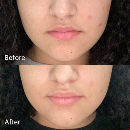 Calendula Peel Off Mask